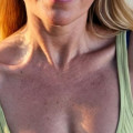 Malin